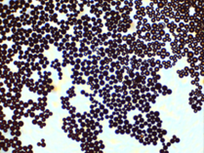Macroporous Adsorbent Resin